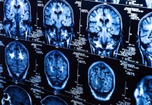 How Gratitude Changes Your Brain: (10 Scientific Studies) how gratitude changes the brain